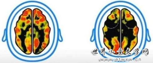 迷恋电视手机,孩子大脑会发生什么变化?几组数据让人触目惊心
